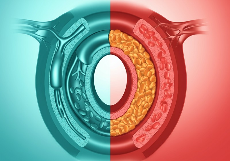 Cholesterol numbers explained